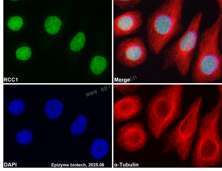 Anti-RCC1 Rabbit mAb [59A49B22]