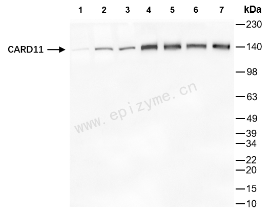 Anti-CARD11 Rabbit mAb [16I25F35]