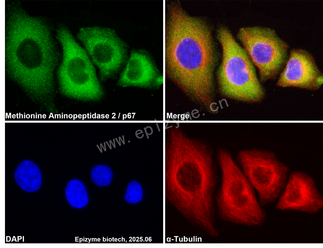 Anti-Methionine Aminopeptidase 2 Rabbit mAb [41K76M84]