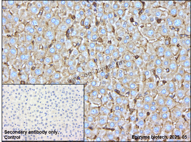 Anti-Methionine Aminopeptidase 2 Rabbit mAb [41K76M84]