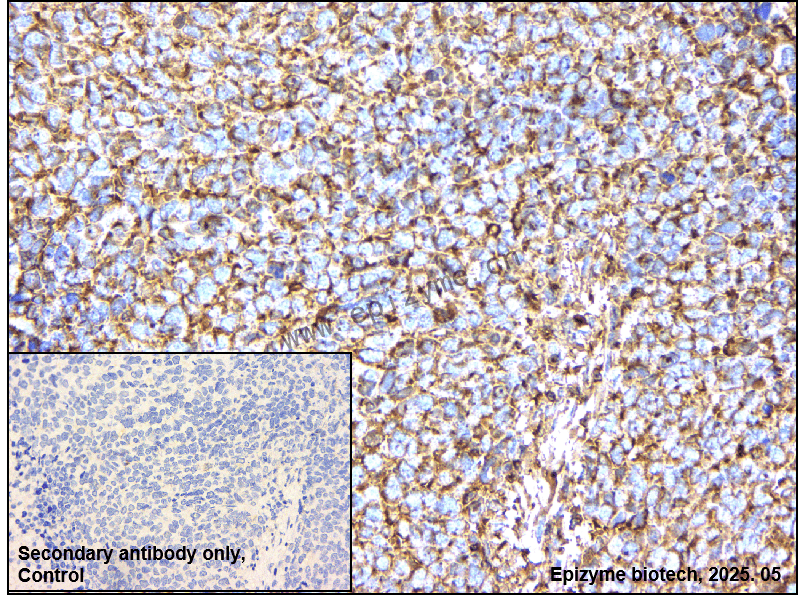 Anti-Methionine Aminopeptidase 2 Rabbit mAb [41K76M84]
