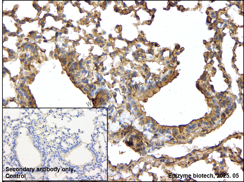 Anti-Methionine Aminopeptidase 2 Rabbit mAb [41K76M84]
