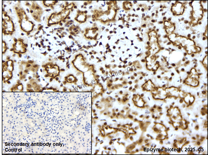 Anti-ILF3 Rabbit mAb [23L15K59]