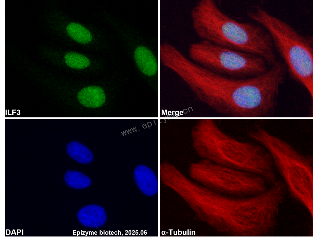 Anti-ILF3 Rabbit mAb [23L15K59]