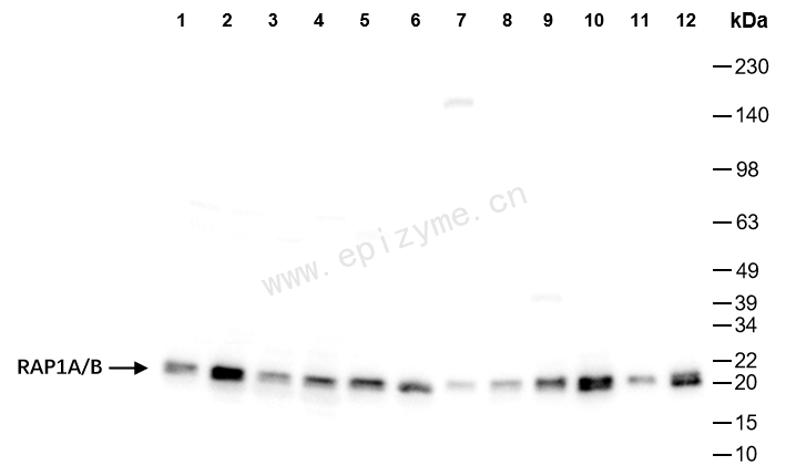 Anti-RAP1A/B Rabbit mAb [36M99L04]