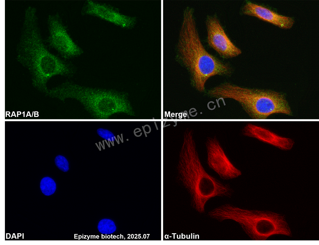 Anti-RAP1A/B Rabbit mAb [36M99L04]