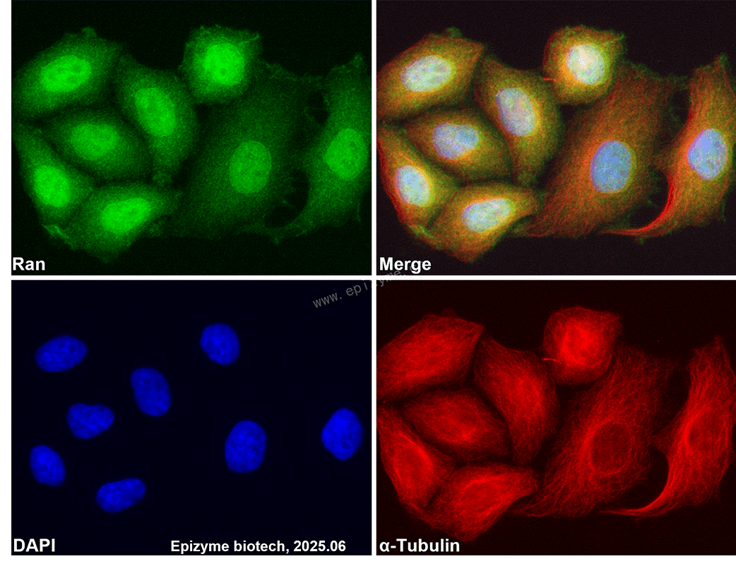 Anti-Ran Rabbit mAb [59M38K13]