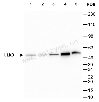 Anti-ULK3 Rabbit mAb [41L97M82]