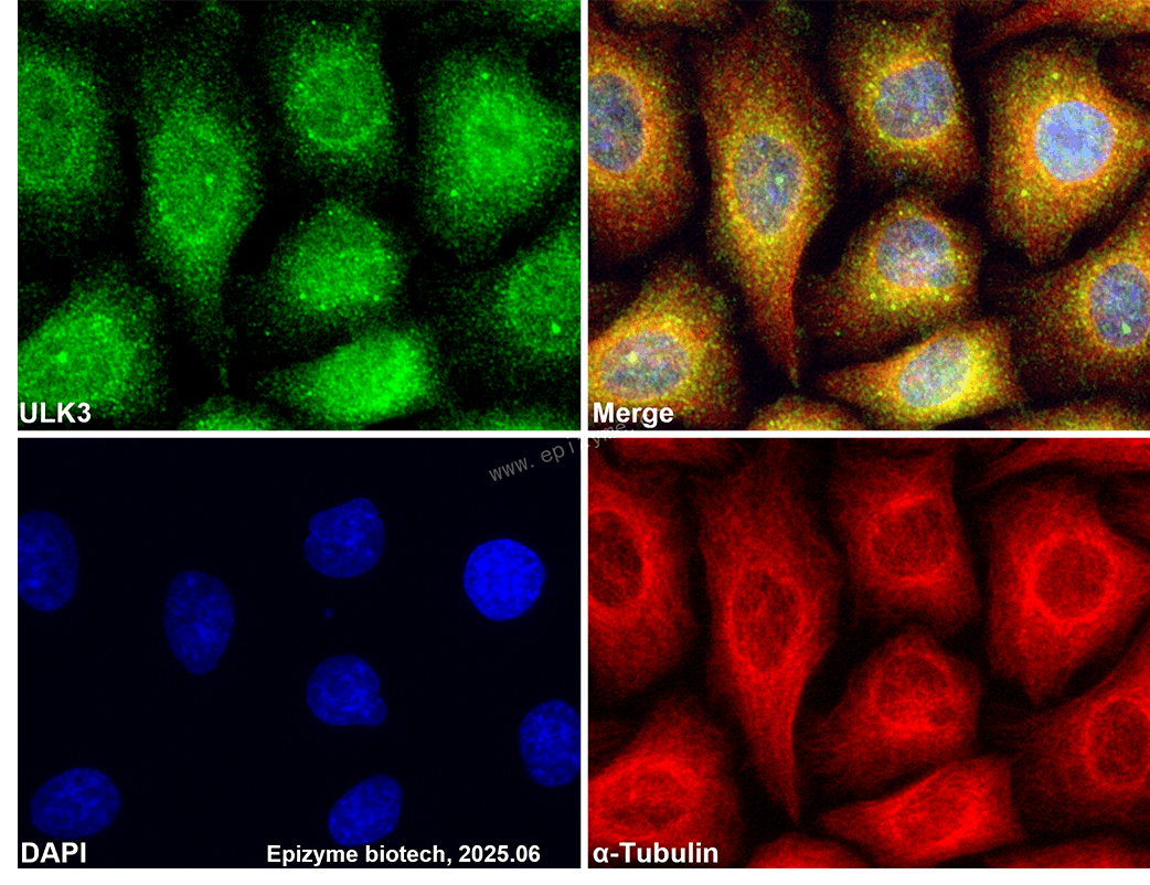Anti-ULK3 Rabbit mAb [41L97M82]