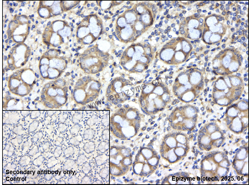 Anti-ULK3 Rabbit mAb [41L97M82]