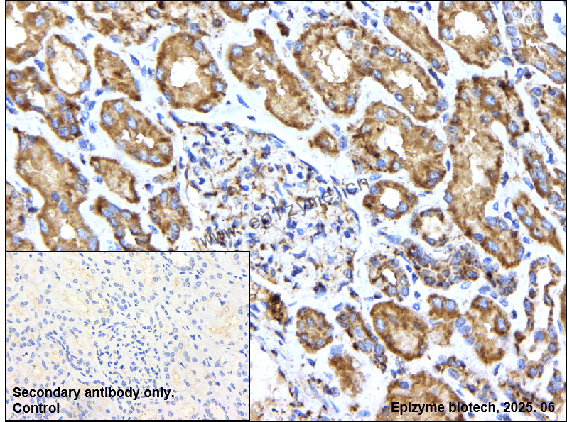 Anti-ULK3 Rabbit mAb [41L97M82]