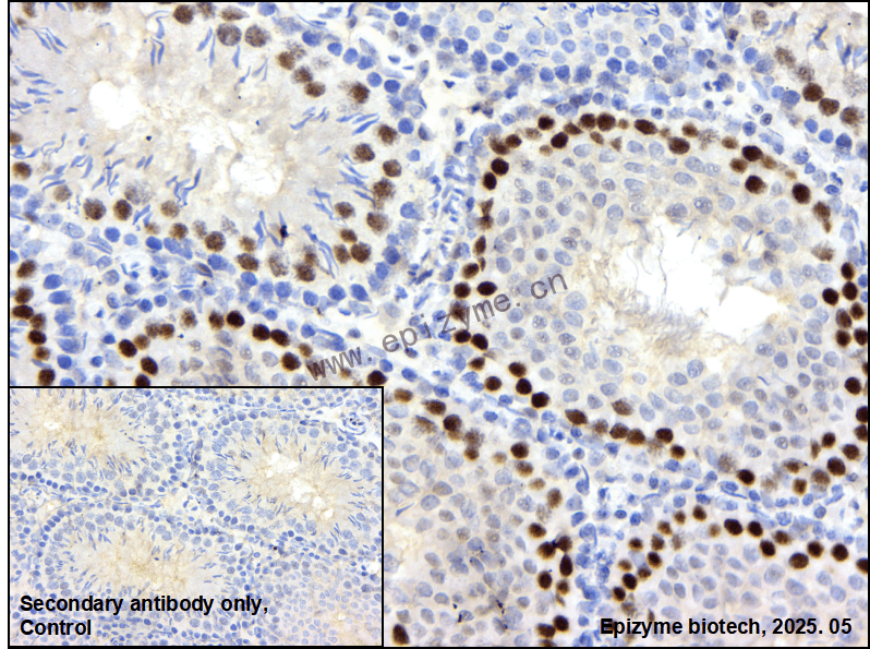 Anti-PCGF6 Rabbit mAb [67L28M77]