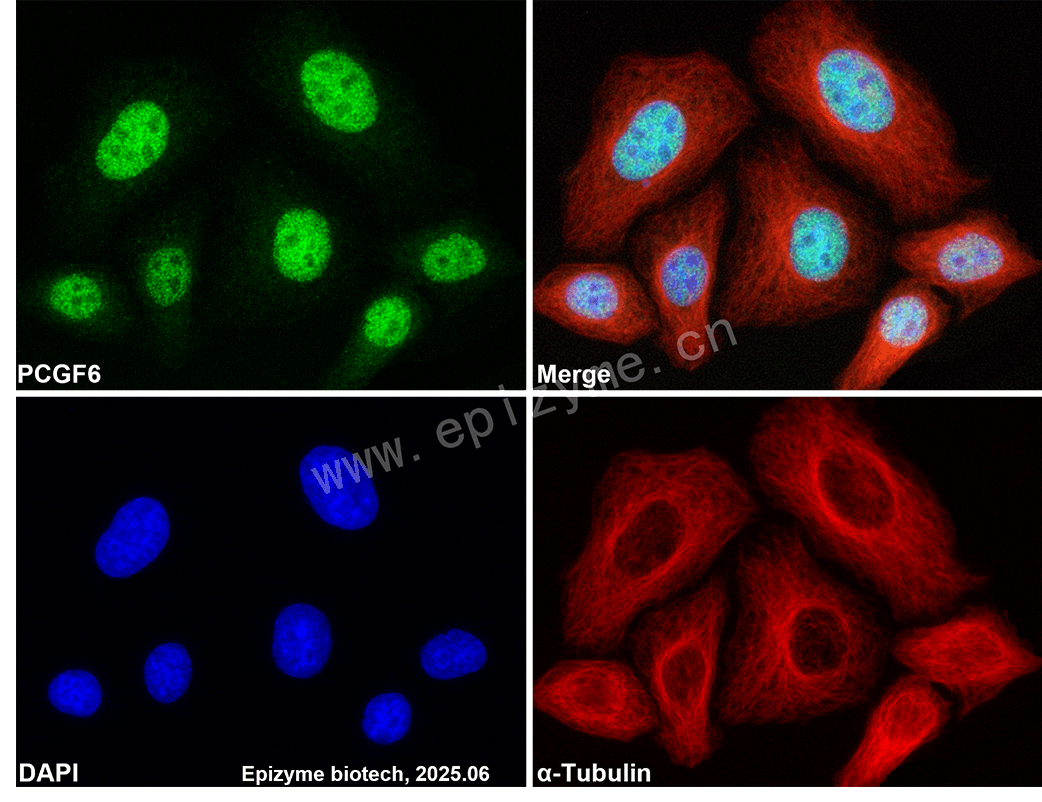 Anti-PCGF6 Rabbit mAb [67L28M77]