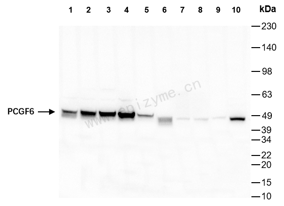 Anti-PCGF6 Rabbit mAb [67L28M77]