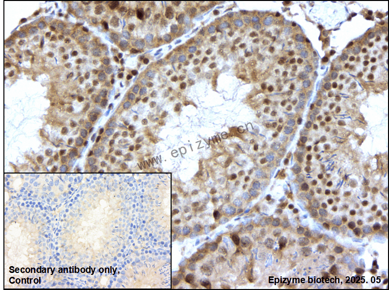 Anti-p95/NBS1 Rabbit mAb [58M43K29]