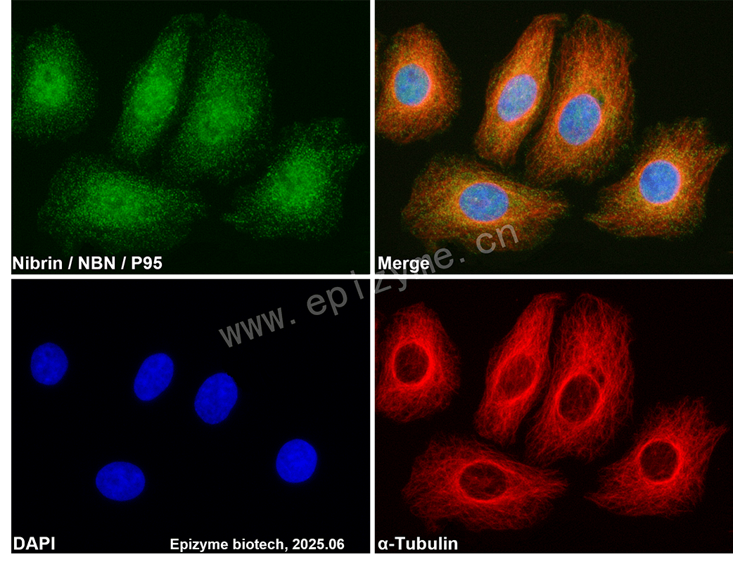 Anti-p95/NBS1 Rabbit mAb [58M43K29]