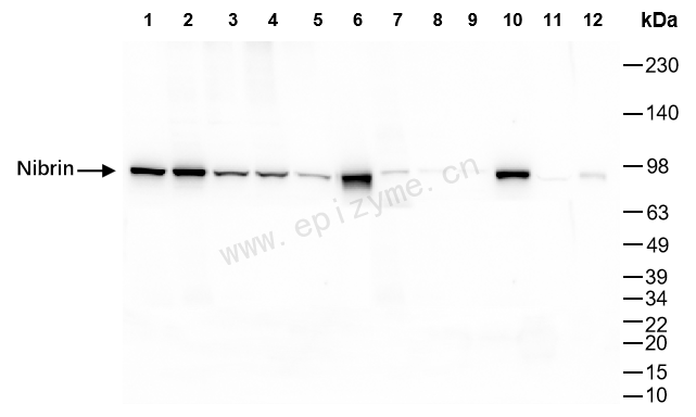 Anti-p95/NBS1 Rabbit mAb [58M43K29]