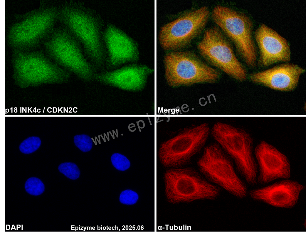Anti-CDKN2C Rabbit mAb [57K37L47]