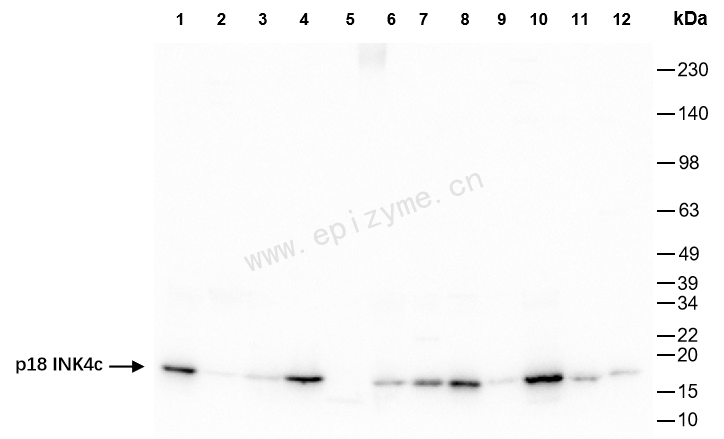 Anti-CDKN2C Rabbit mAb [57K37L47]