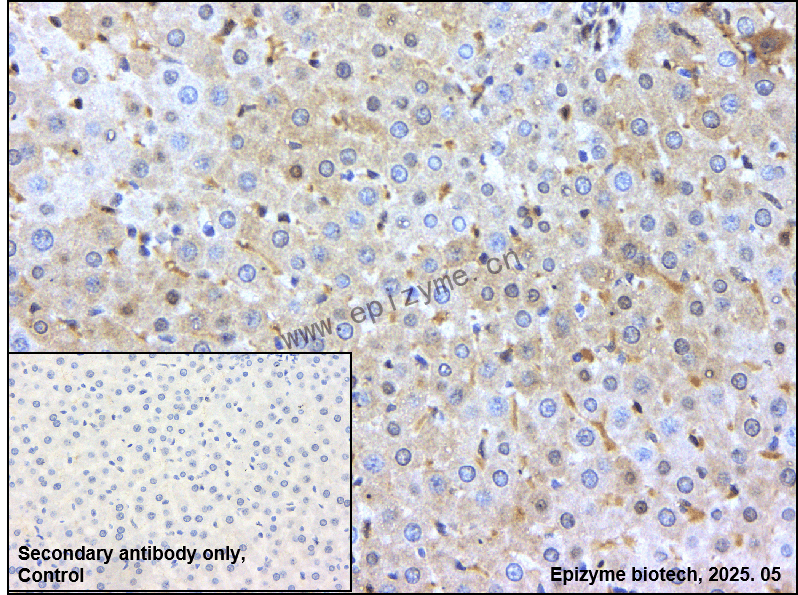 Anti-CDKN2C Rabbit mAb [57K37L47]