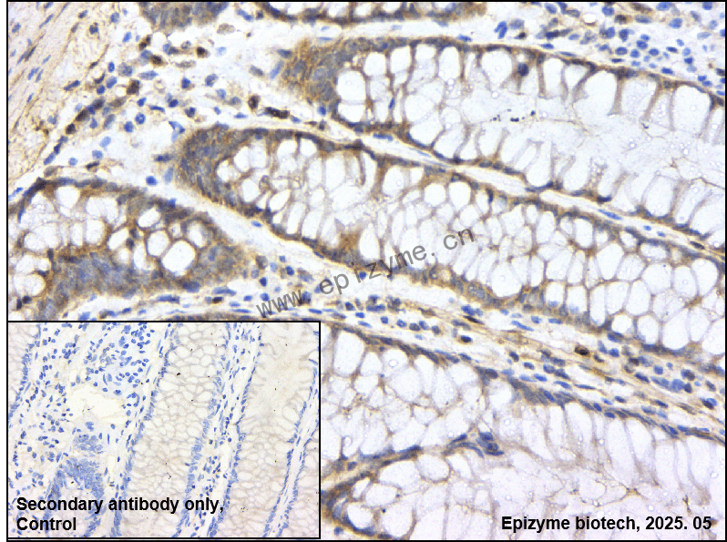 Anti-CDKN2C Rabbit mAb [57K37L47]