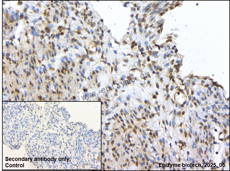 Anti-CDKN2C Rabbit mAb [57K37L47]
