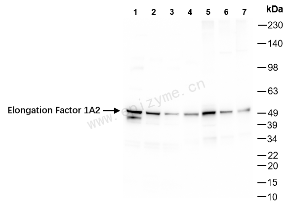 Anti-Elongation Factor 1A2 Rabbit mAb [51M31L89]