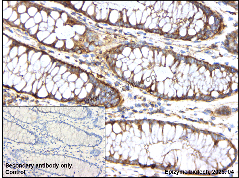 Anti-MetRS Rabbit mAb [85K64L99]