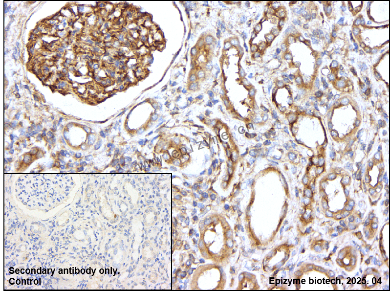 Anti-MetRS Rabbit mAb [85K64L99]