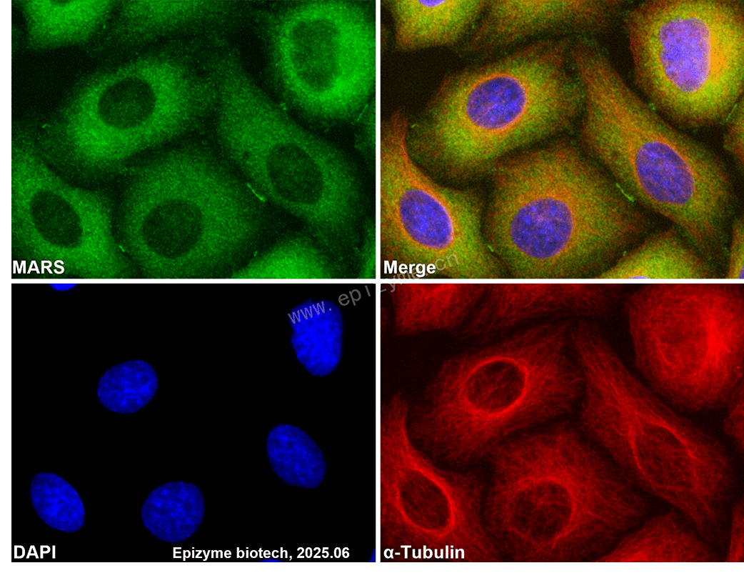 Anti-MetRS Rabbit mAb [85K64L99]