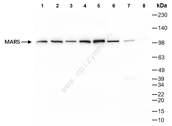 Anti-MetRS Rabbit mAb [85K64L99]