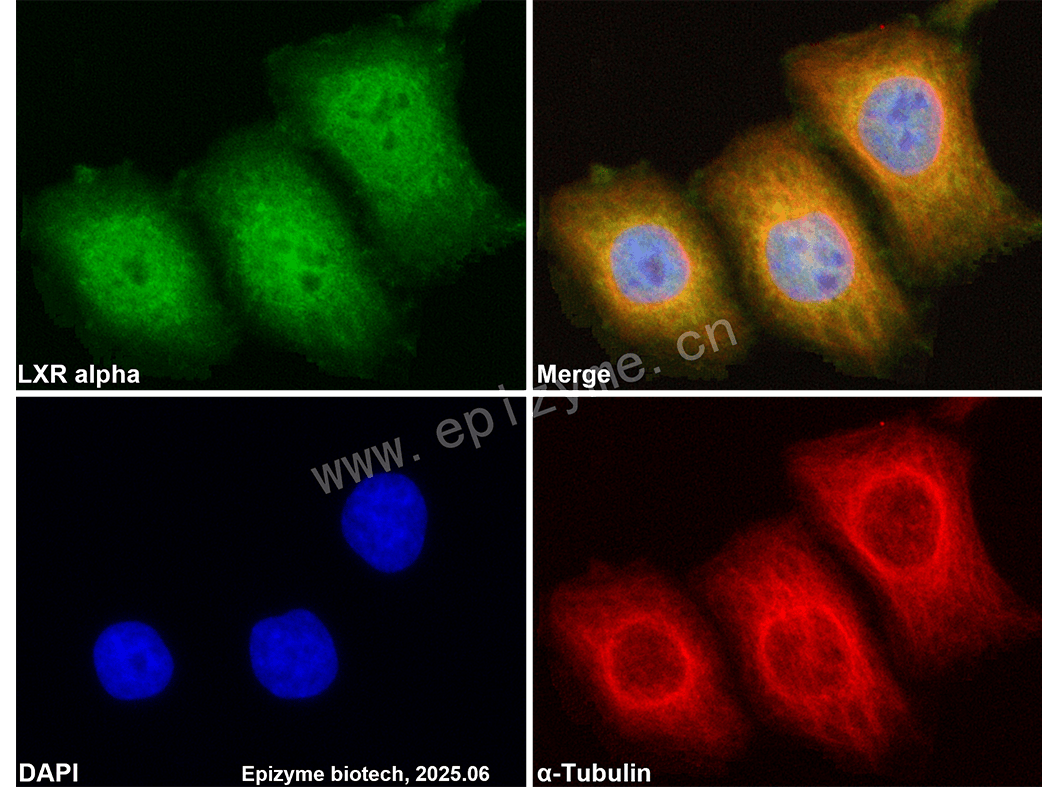 Anti-LXR alpha Rabbit mAb [12K97M67]