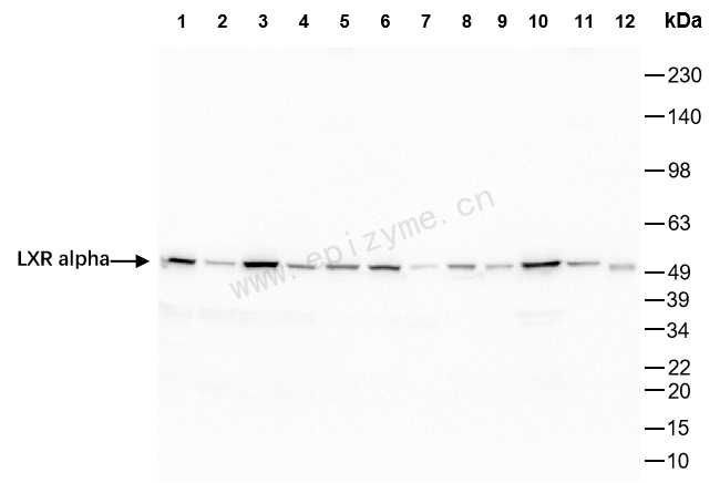 Anti-LXR alpha Rabbit mAb [12K97M67]