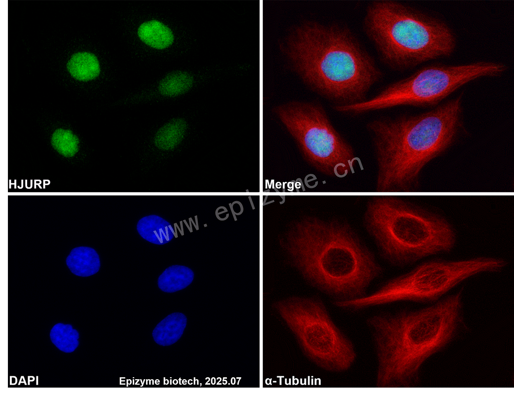 Anti-HJURP Rabbit mAb [66L35M45]