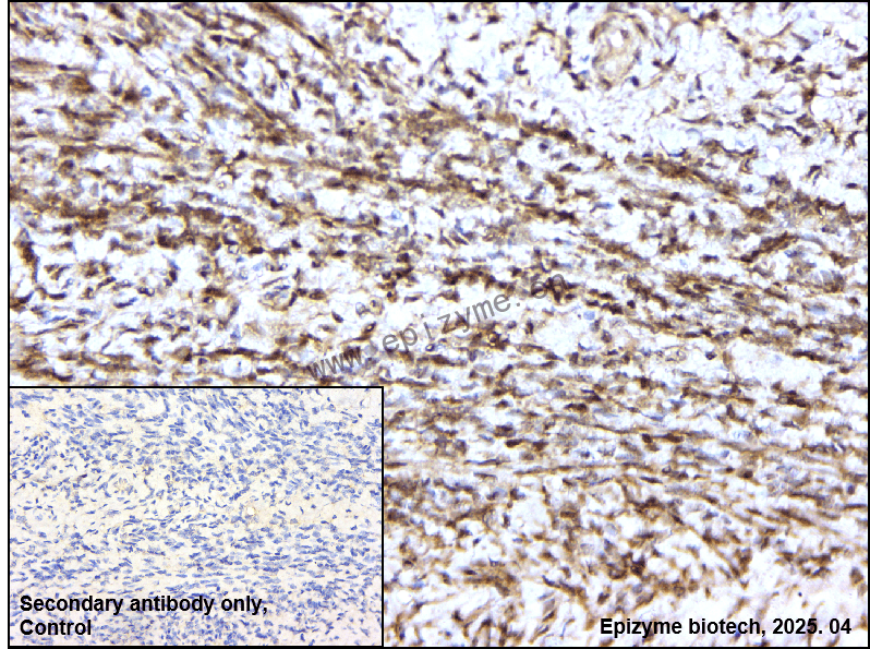 Anti-Phospho-PKC alpha (Thr638) Rabbit mAb [35M52M62]