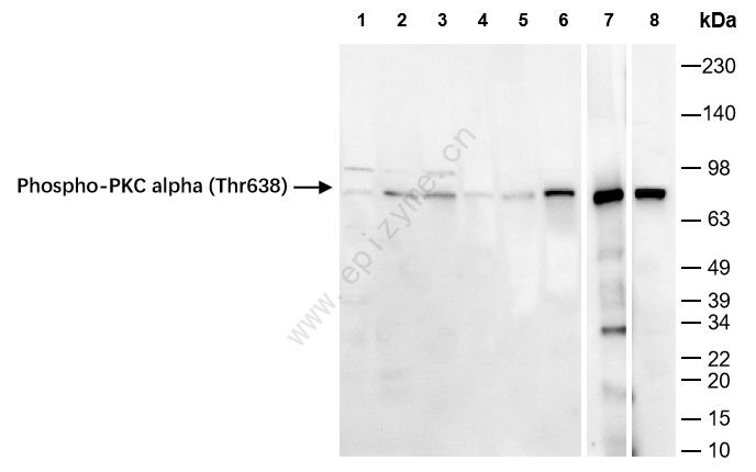 Anti-Phospho-PKC alpha (Thr638) Rabbit mAb [35M52M62]