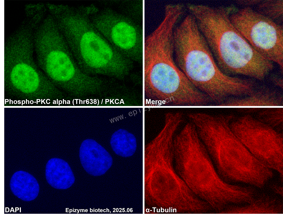 Anti-Phospho-PKC alpha (Thr638) Rabbit mAb [35M52M62]