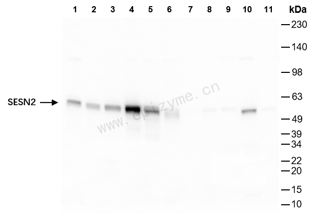 Anti-SESN2 Rabbit mAb [17M05M30]