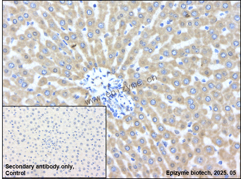 Anti-SESN2 Rabbit mAb [17M05M30]
