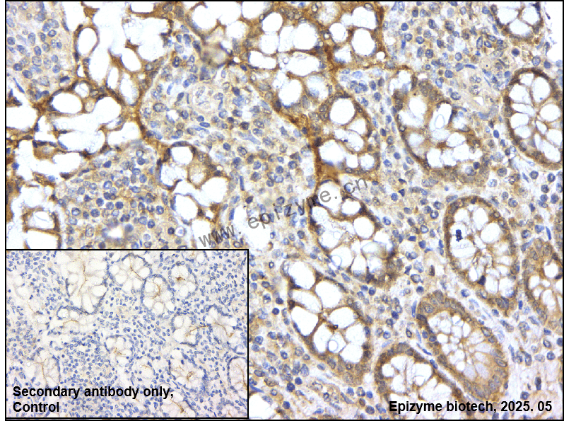Anti-SESN2 Rabbit mAb [17M05M30]