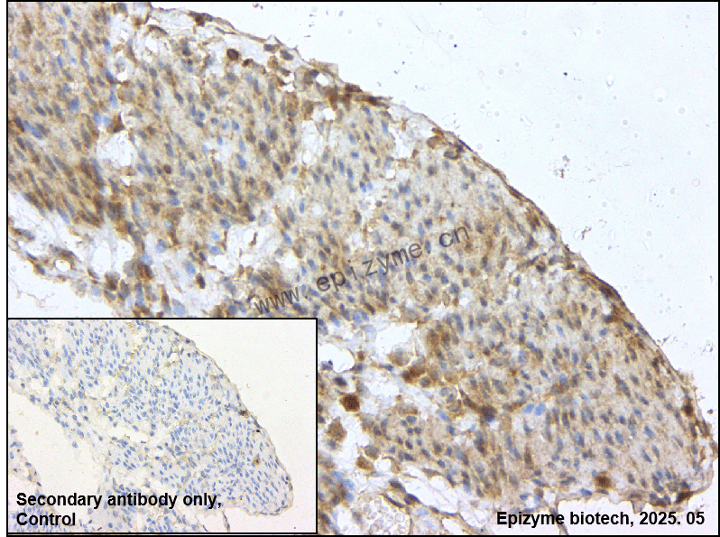 Anti-SESN2 Rabbit mAb [17M05M30]