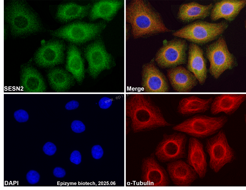 Anti-SESN2 Rabbit mAb [17M05M30]