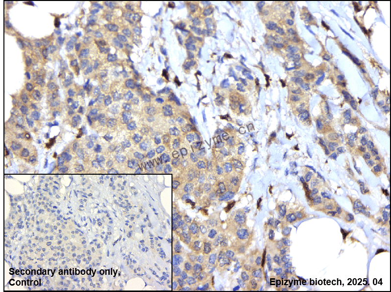 Anti-Phospho-PKC (Ser660) Rabbit mAb [68K33K11]