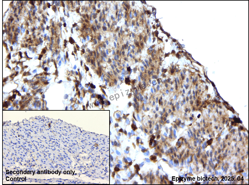 Anti-Phospho-PKC (Ser660) Rabbit mAb [68K33K11]
