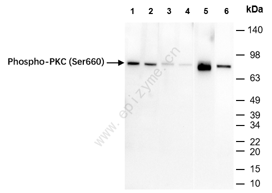 Anti-Phospho-PKC (Ser660) Rabbit mAb [68K33K11]