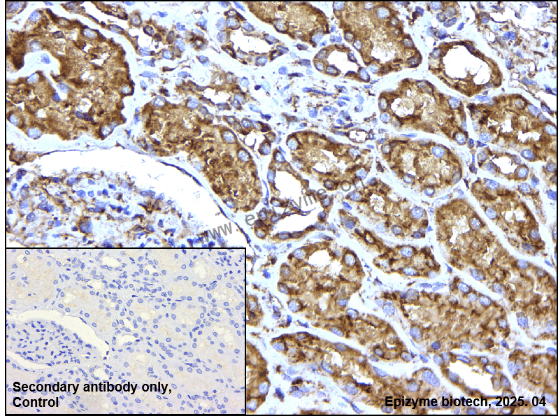 Anti-PDIA1 (PDI) Rabbit mAb [75K43M54]