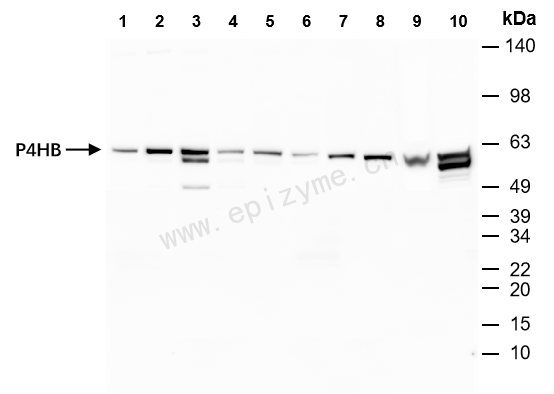 Anti-PDIA1 (PDI) Rabbit mAb [75K43M54]