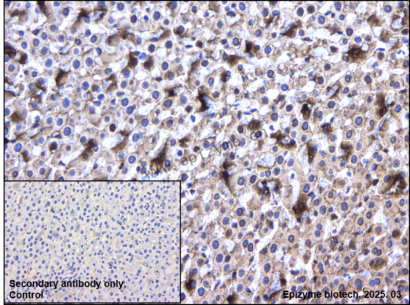 Anti-GPCR LGR6 Rabbit mAb [64K62M94]