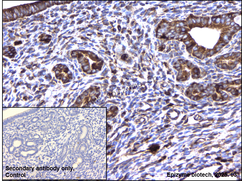 Anti-GPCR LGR6 Rabbit mAb [64K62M94]