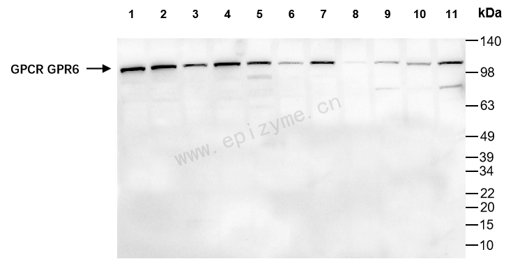 Anti-GPCR LGR6 Rabbit mAb [64K62M94]